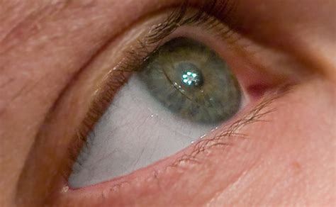 contact lenses for double vision