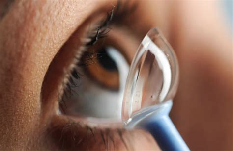 keratoconus contact lenses cost